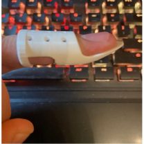 Distal İnterfalangeal DIP Ateli